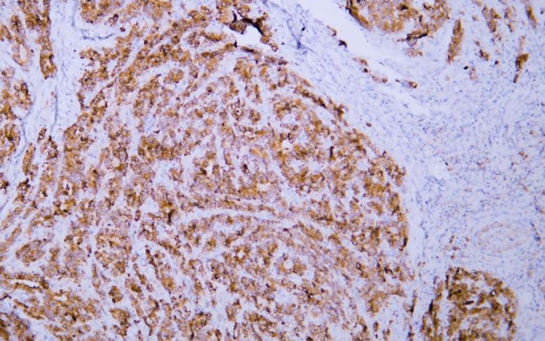V0395