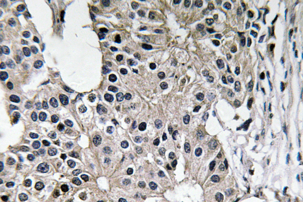 R12-2055