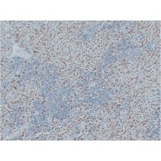 Anti-Wilms' Tumor 1(WT1)  antibody [ABT-WT1]