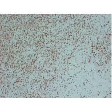 Anti-ZAP-70  antibody [ABT-ZAP70]