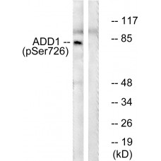 ADD1 (Phospho-Ser726) Antibody