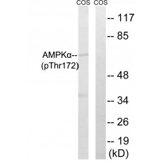 AMPK alpha 1/2 (Phospho-Thr183/172) Antibody