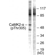 CaMK2 alpha/beta/delta (Phospho-Thr305) Antibody