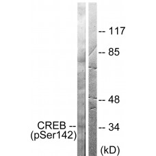 CREB (Phospho-Ser142) Antibody