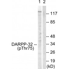 DARPP-32 (Phospho-Thr75) Antibody