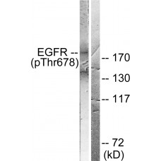 EGFR (Phospho-Thr678) Antibody
