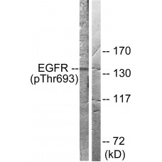 EGFR (Phospho-Thr693) Antibody