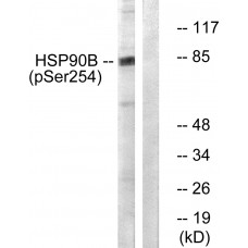 HSP90B (Phospho-Ser254) Antibody