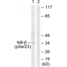 IkappaB-beta (Phospho-Ser23) Antibody