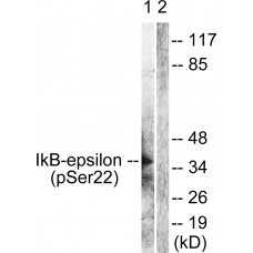 IkappaB-epsilon (Phospho-Ser22) Antibody