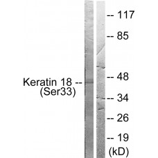 Keratin 18 (Phospho-Ser33) Antibody