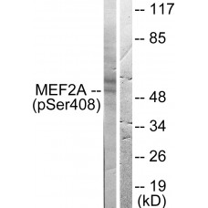 MEF2A (Phospho-Ser408) Antibody