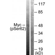 Myc (Phospho-Ser62) Antibody