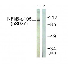 NF-kappaB p105/p50 (Phospho-Ser927) Antibody