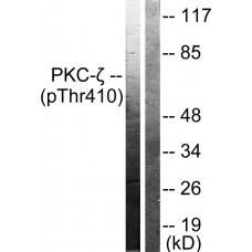 PKC zeta (Phospho-Thr410) Antibody