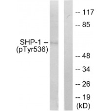 SHP-1 (Phospho-Tyr536) Antibody