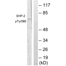SHP-2 (Phospho-Tyr580) Antibody