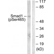 Smad1 (Phospho-Ser465) Antibody