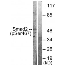 Smad2 (Phospho-Ser467) Antibody