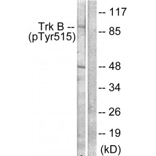 Trk B (Phospho-Tyr515) Antibody