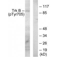 Trk B (Phospho-Tyr705) Antibody
