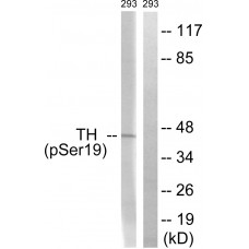 Tyrosine Hydroxylase (Phospho-Ser19) Antibody