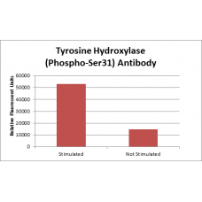 Tyrosine Hydroxylase (Phospho-Ser31) Fluorometric Cell-Based ELISA Kit
