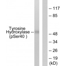 Tyrosine Hydroxylase (Phospho-Ser40) Antibody