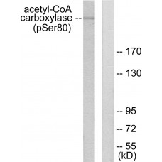 Acetyl-CoA Carboxylase (Phospho-Ser80) Antibody