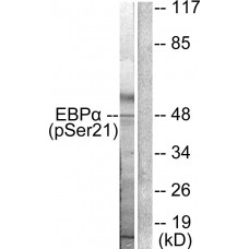 C/EBP-alpha (Phospho-Ser21) Antibody
