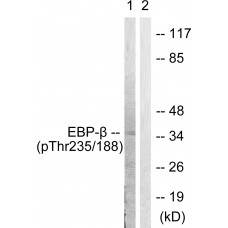 C/EBP-beta (Phospho-Thr235/188) Antibody
