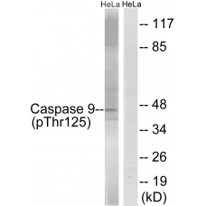 Caspase 9 (Phospho-Thr125) Antibody
