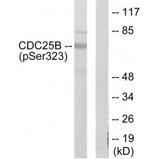 CDC25B (Phospho-Ser323) Antibody