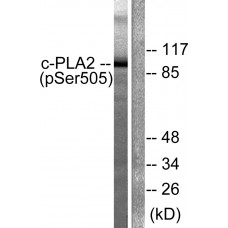 c-PLA2 (Phospho-Ser505) Antibody