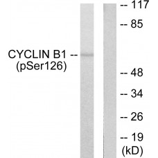 Cyclin B1 (Phospho-Ser126) Antibody
