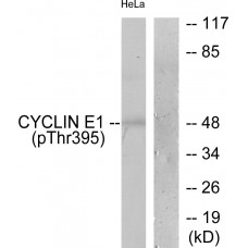 Cyclin E1 (Phospho-Thr395) Antibody