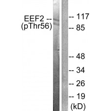 eEF2 (Phospho-Thr56) Antibody