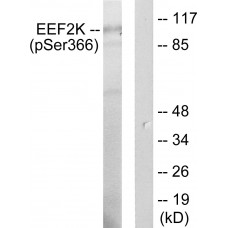 eEF2K (Phospho-Ser366) Antibody