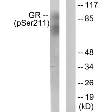 GR (Phospho-Ser211) Antibody