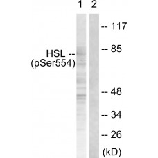 HSL (Phospho-Ser855/554) Antibody