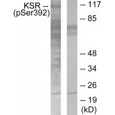 KSR (Phospho-Ser392) Antibody