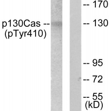 p130 Cas (Phospho-Tyr410) Antibody