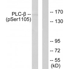 PLCB3 (Phospho-Ser1105) Antibody