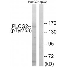 PLCG2 (Phospho-Tyr753) Antibody