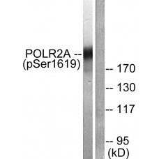 POLR2A (Phospho-Ser1619) Antibody
