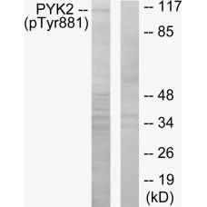 PYK2 (Phospho-Tyr881) Antibody