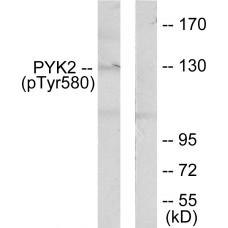 PYK2 (Phospho-Tyr580) Antibody