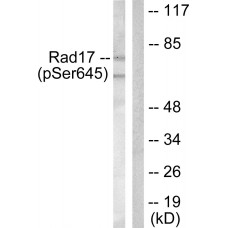 RAD17 (Phospho-Ser645) Antibody