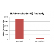 SRF (Phospho-Ser99) Fluorometric Cell-Based ELISA Kit