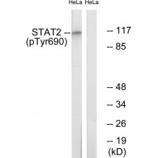 STAT2 (Phospho-Tyr690) Antibody
